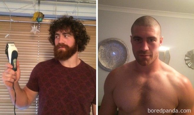 Kyle Amor Shaved His Head And Face To Raise Money