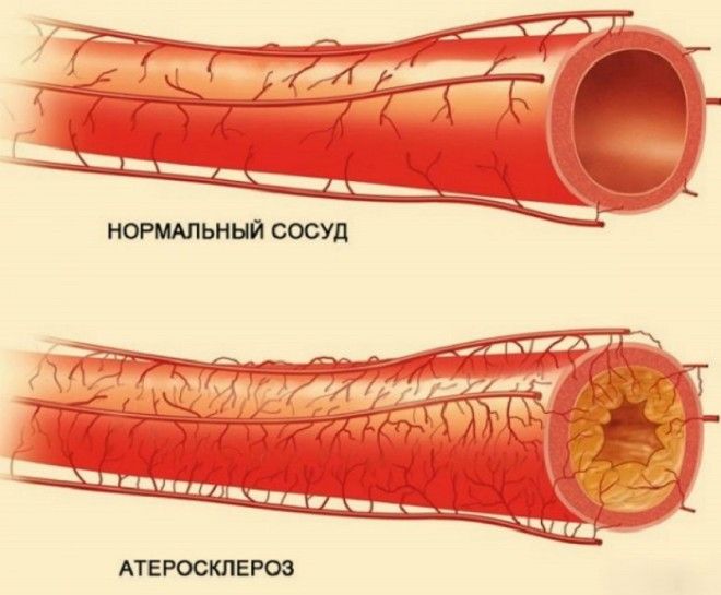 сосуды рисунок