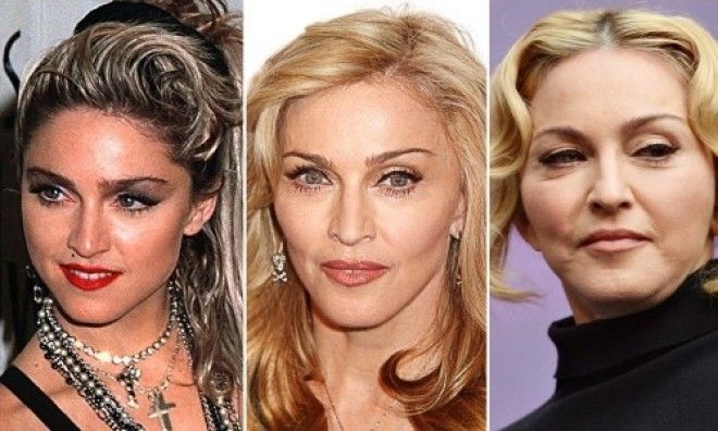 19 знаменитостей утративших былую красоту1