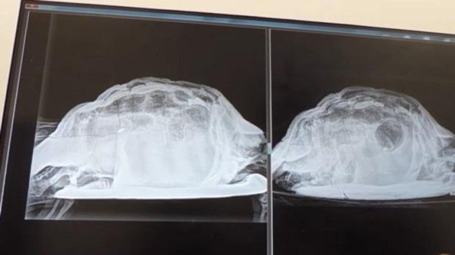 Врачи извлекли мертвую черепаху из вагины молодой британки ynews вечеринка гинеколог изнасилование инородные предметы черепаха