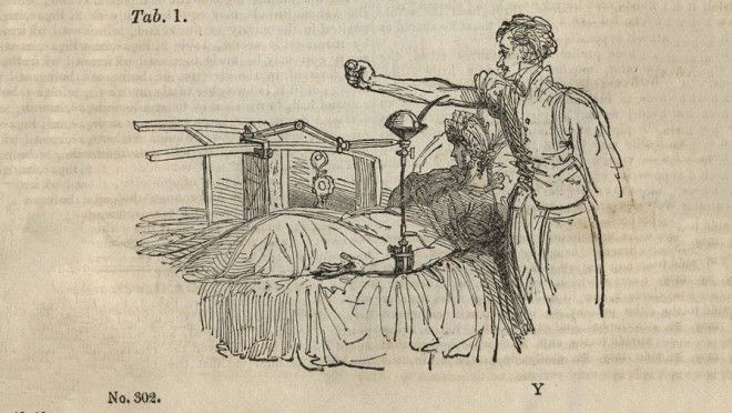 Рисунок в статье Джеймса Бланделла «Наблюдения при переливании крови», 1829 год